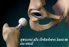 કોરોના વાઇસ હવે ભૂતકાળ બની ગયો છે પણ તેની અસર હજુ કોઇને કોઇ રીતે સ્વાસ્થ્ય પર જોવા મળે છે , હીપ રિપ્લેસમેન્ટના કેસમાં 40 ટકા વધારો, 80 ટકા લોકો તો 50થી ઓછી વયના ,